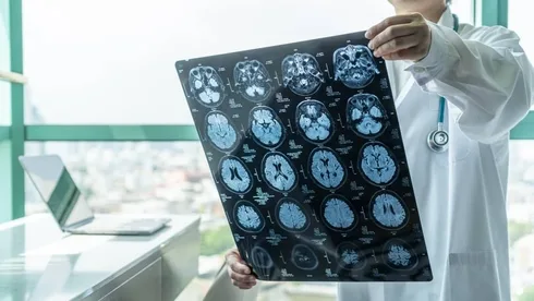 Brain Diagnosis Photo of Brain Diagnosis